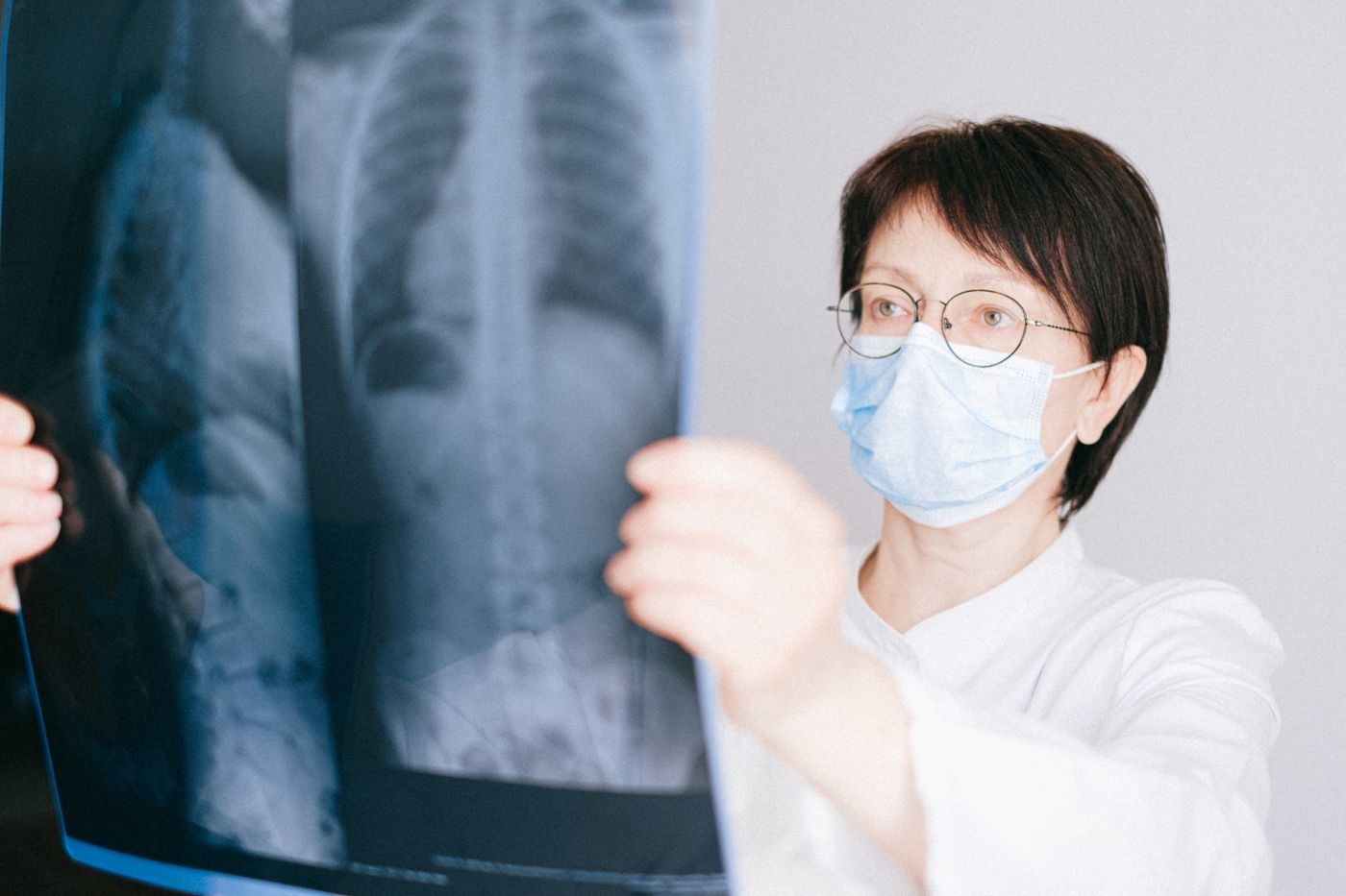 Doctor examining a chest X-ray